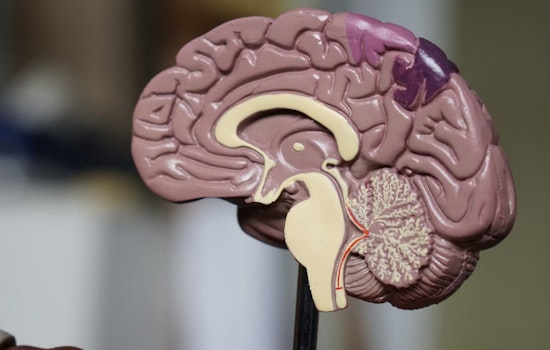 MIT Brain Team Blames Tiny RNA For Rett’s Leaky Vessel Problem