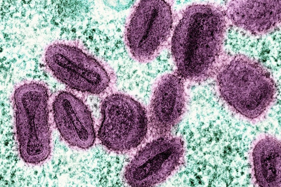 More Severe Mpox Strain Hits NYC Via Returning European Traveler