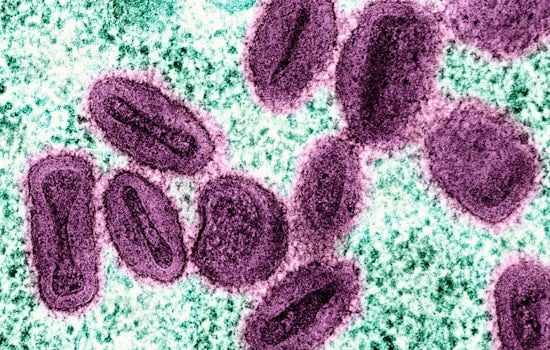 More Severe Mpox Strain Hits NYC Via Returning European Traveler
