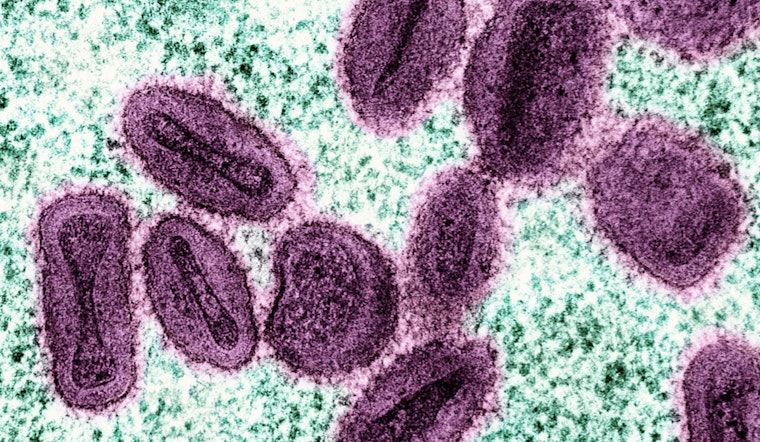 More Severe Mpox Strain Hits NYC Via Returning European Traveler
