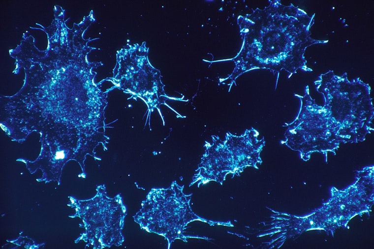 New Cancer Hot-Spot Maps Put East Harris County Under the Microscope