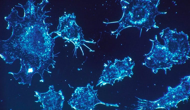 New Cancer Hot-Spot Maps Put East Harris County Under the Microscope