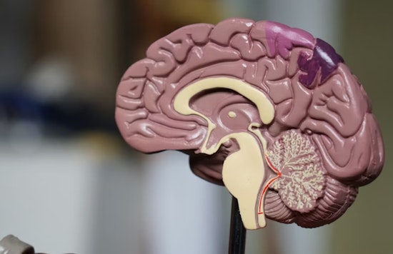 Northwestern Researchers Link Fructose Metabolism To Glioblastoma Growth