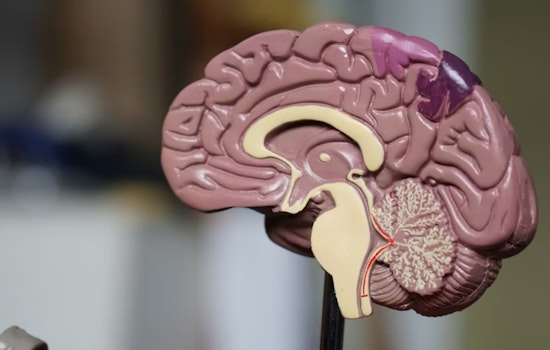 Northwestern Researchers Link Fructose Metabolism To Glioblastoma Growth