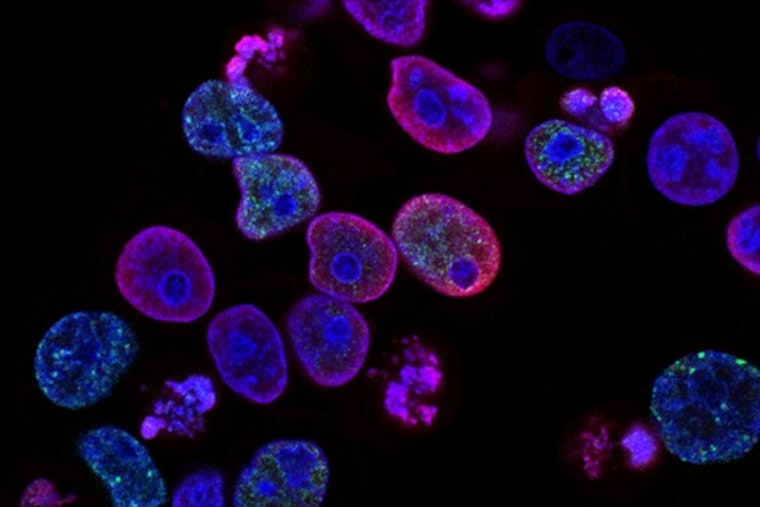 San Diego Cancer Labs Fear Breakthroughs Will Flatline as NIH Cash Stalls