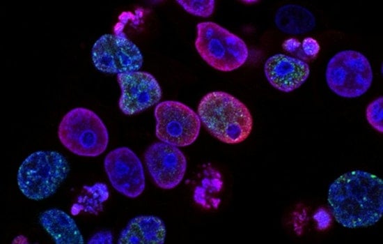 San Diego Cancer Labs Fear Breakthroughs Will Flatline as NIH Cash Stalls
