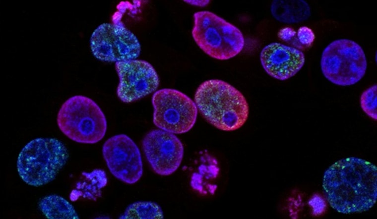 San Diego Cancer Labs Fear Breakthroughs Will Flatline as NIH Cash Stalls