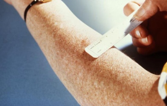 TB Scare Rocks Southwest High As County Alerts Students And Staff