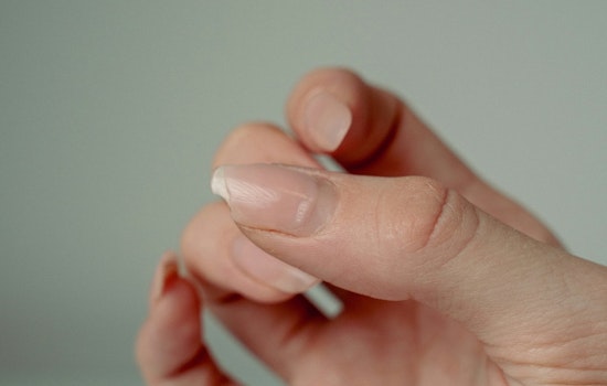 Texas Tech Team Says Fentanyl Leaves A Telltale Trail In Your Nails