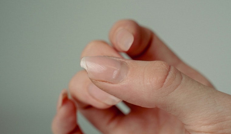 Texas Tech Team Says Fentanyl Leaves A Telltale Trail In Your Nails