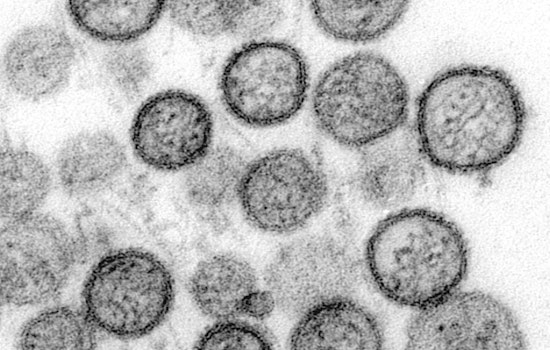 UT Austin Lab Cracks Deadly Virus Map, Puts Hantavirus Vaccine In Sight