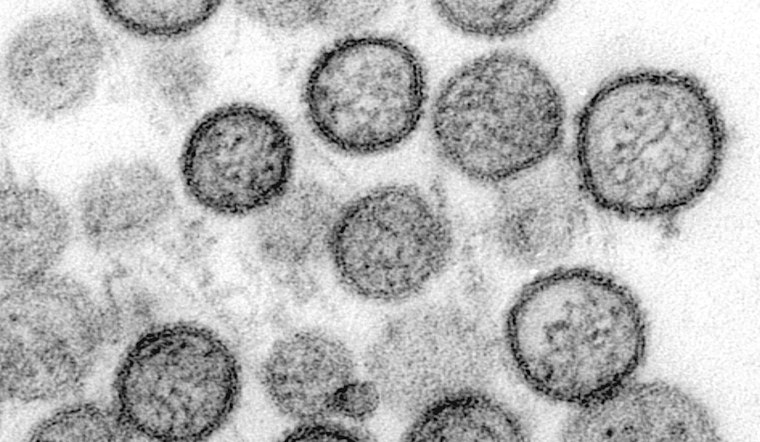 UT Austin Lab Cracks Deadly Virus Map, Puts Hantavirus Vaccine In Sight