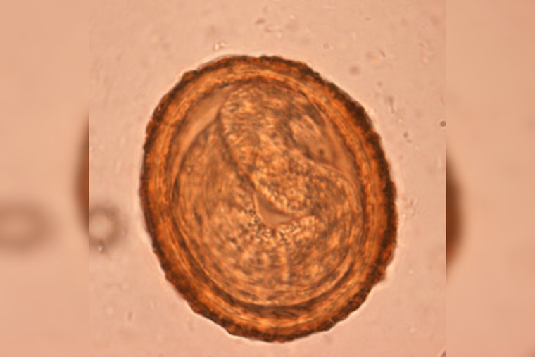 Woodland Hills Dog Tests Positive For Raccoon Roundworm