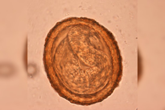 Woodland Hills Dog Tests Positive For Raccoon Roundworm