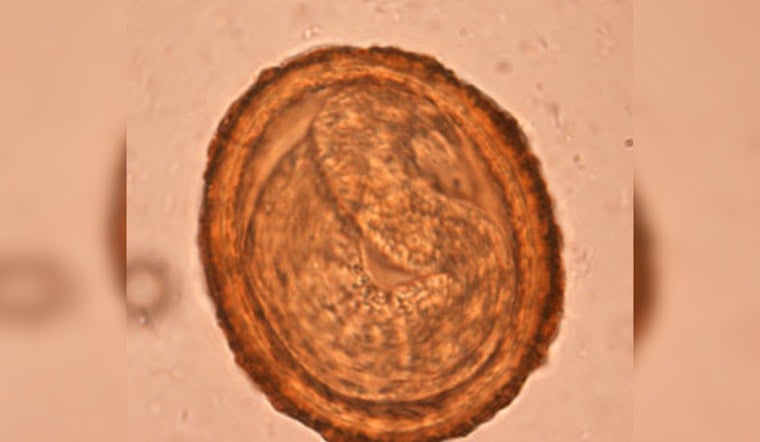 Woodland Hills Dog Tests Positive For Raccoon Roundworm