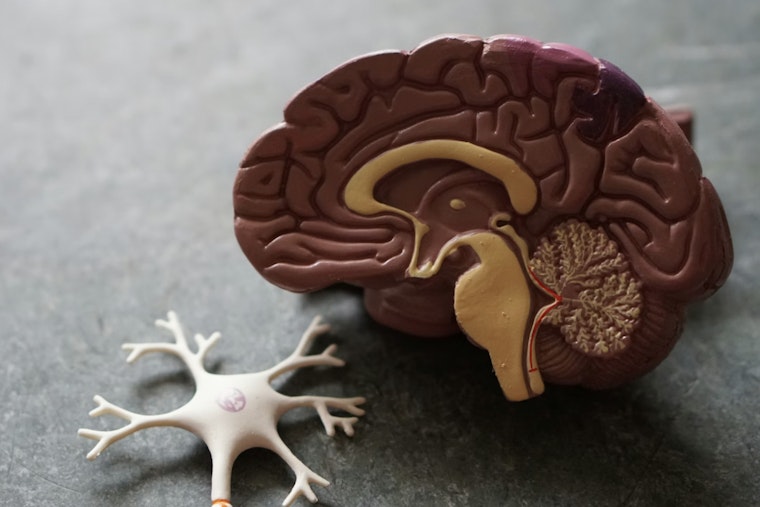 Worcester Brain Lab’s AI Nails Alzheimer’s Clues With 93% Accuracy