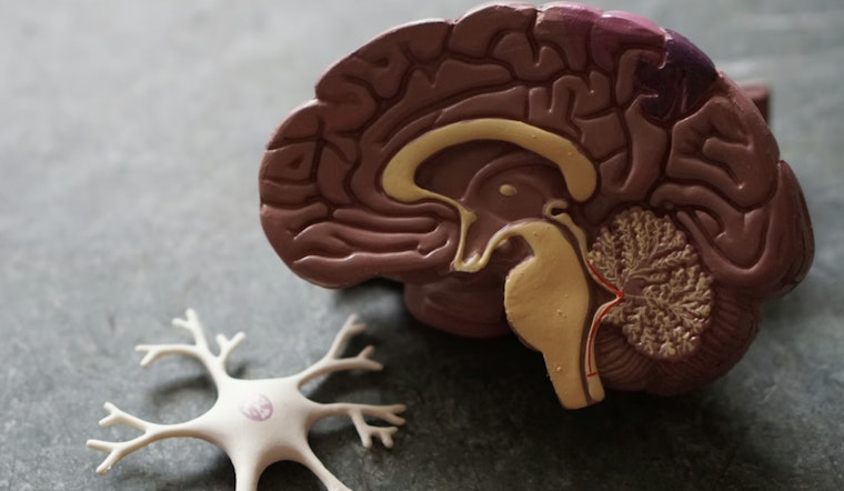 Worcester Brain Lab’s AI Nails Alzheimer’s Clues With 93% Accuracy