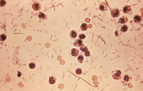 Bloody-Diarrhea Superbug Creeps Across New York State