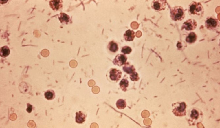 Bloody-Diarrhea Superbug Creeps Across New York State