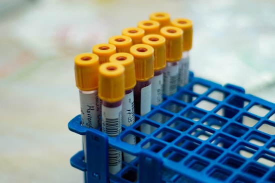 Boston Brain Docs Unveil Blood Test That Flags Alzheimer’s Years Before It Strikes
