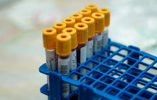 Boston Brain Docs Unveil Blood Test That Flags Alzheimer’s Years Before It Strikes