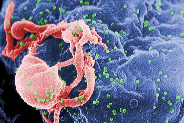 HIV Surge on Chicago’s West Side Has Docs Sounding the Alarm