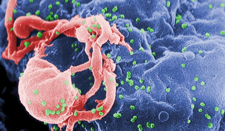 HIV Surge on Chicago’s West Side Has Docs Sounding the Alarm