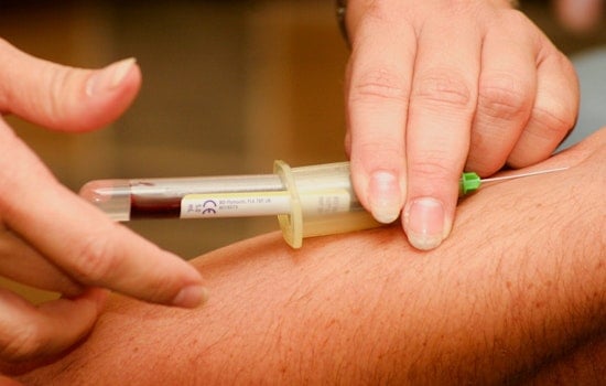 Chicago Patients Clamor For Alzheimer’s Blood Test As Doctors Hit The Brakes