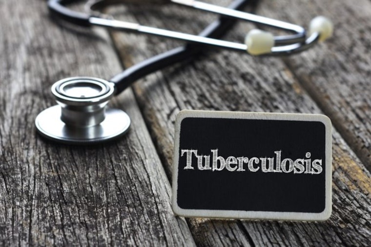 Drug-Resistant TB Scare Shakes Southwestern College As County Warns