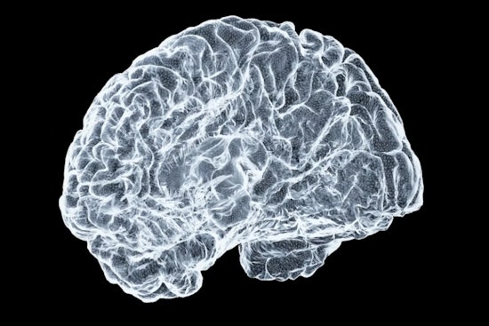 Framingham Brain-Drug Upstart Snags $106 Million War Chest