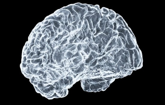 Framingham Brain-Drug Upstart Snags $106 Million War Chest