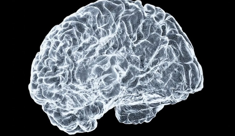 Framingham Brain-Drug Upstart Snags $106 Million War Chest