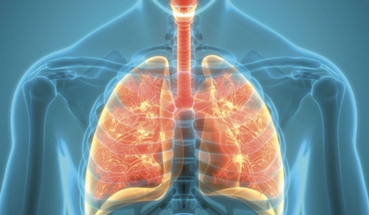 Houston Is Texas' Tuberculosis Hotspot, New County Report Warns