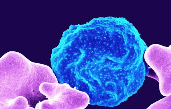 La Jolla Labs Roll Out Triple-Strike Attack On Stubborn Ovarian Cancer