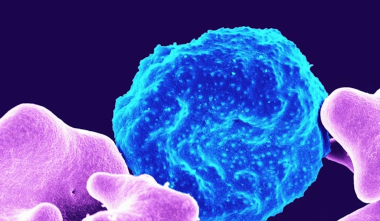 La Jolla Labs Roll Out Triple-Strike Attack On Stubborn Ovarian Cancer
