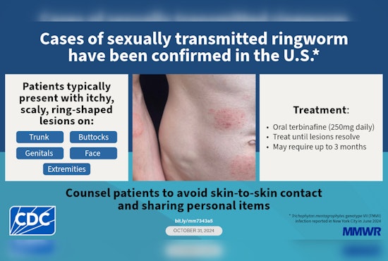 New Sexually Transmitted Fungus Creeps Into King County, Health Officials Sound Alarm