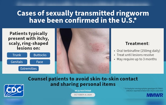 New Sexually Transmitted Fungus Creeps Into King County, Health Officials Sound Alarm