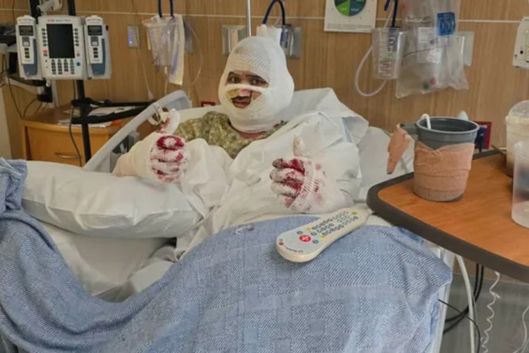 Prescott ‘Team Rocket Professor’ Fighting For Life After Mayer Gas-Line Blast