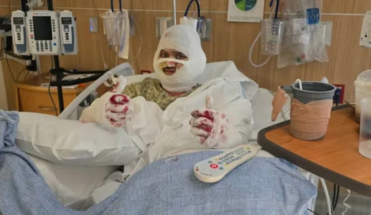 Prescott ‘Team Rocket Professor’ Fighting For Life After Mayer Gas-Line Blast