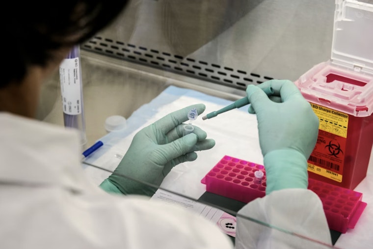 San Antonio Lab Takes Bold Shot At First Measles Antibody Treatment