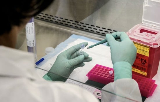 San Antonio Lab Takes Bold Shot At First Measles Antibody Treatment