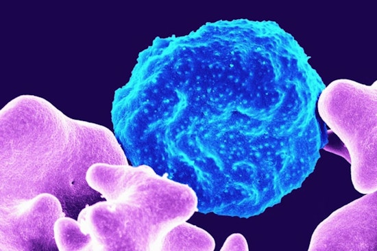 Silent Gas Haunting Detroit Linked to Ovarian Cancer Risk Jump