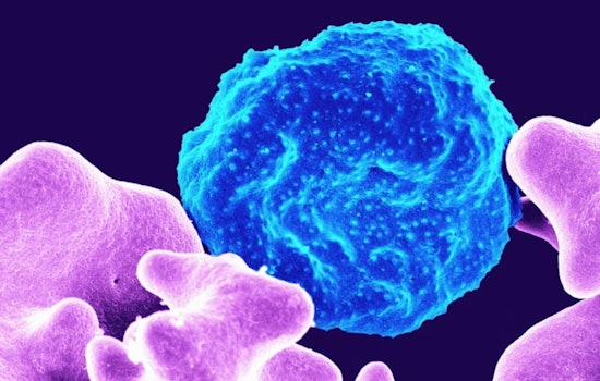 Silent Gas Haunting Detroit Linked to Ovarian Cancer Risk Jump