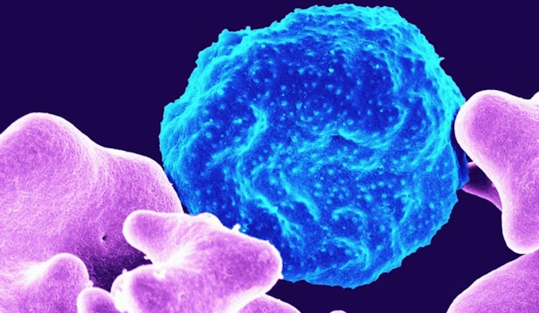 Silent Gas Haunting Detroit Linked to Ovarian Cancer Risk Jump