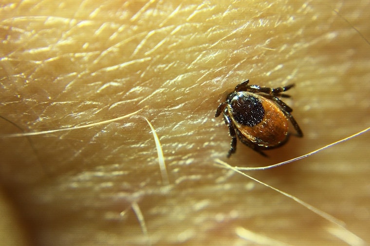 Tick-Related ER Visits Highest In Nearly A Decade