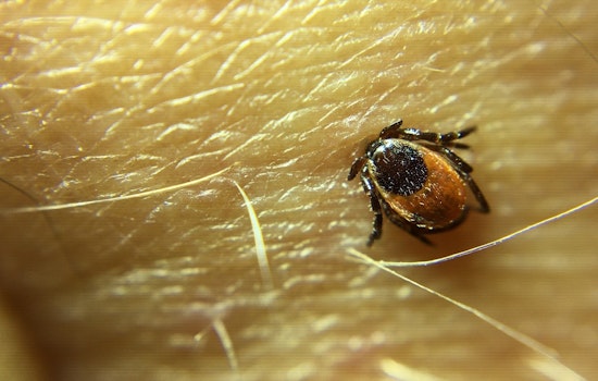 Tick-Related ER Visits Highest In Nearly A Decade