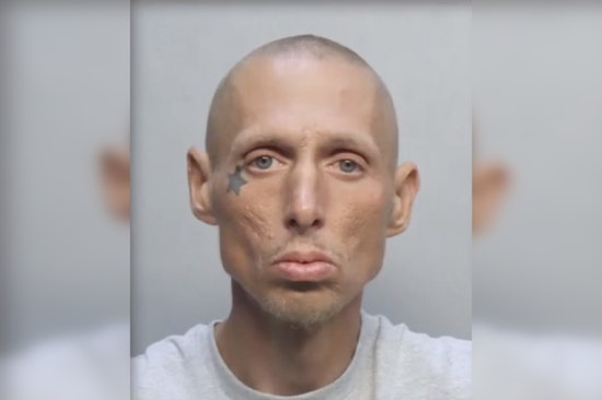 Trash Can Firebug With Star Tattoo Nabbed on Collins Ave, Cops Say