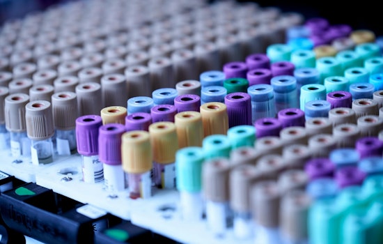 Twin Cities Blood Test May Flag Alzheimer’s Years Before Memory Fades