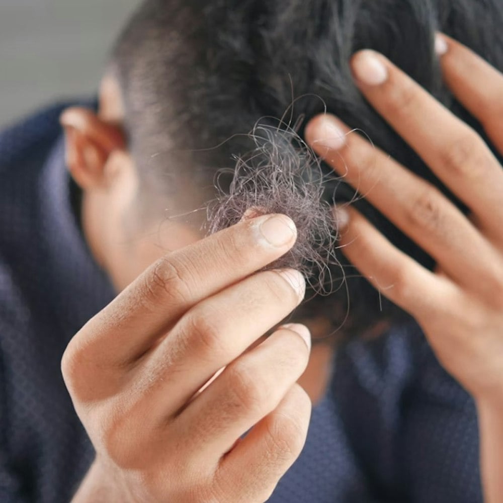 Yes, Ozempic Can Make Your Hair Fall Out. A Doctor at UCSF & Kaiser Just Helped Prove It.