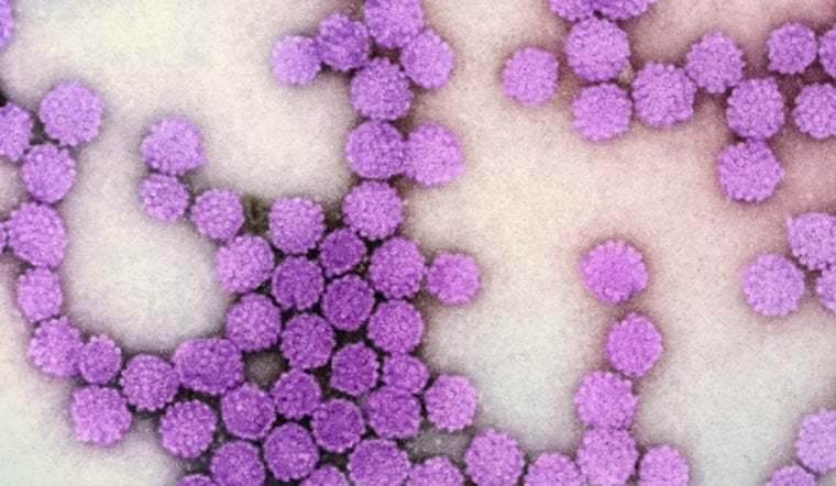 Bepirovirsen Shows Promise As Functional Cure For Hepatitis B